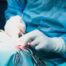 neurosurgery procedures